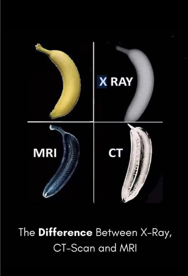 Medical imaging comparison showing the difference between X-Ray, CT-Scan and MRI using a banana